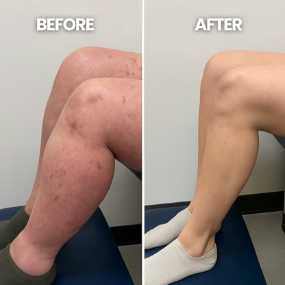 Easoria™ Soothe & Circulate Smart Leg Massager